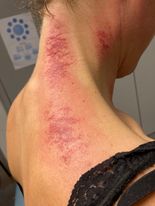 fysiurgisk massage